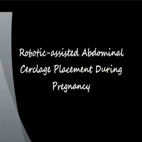 Robotic-Assisted-Abdominal-Cerclage-Placement-During-Pregnancy-Thumb